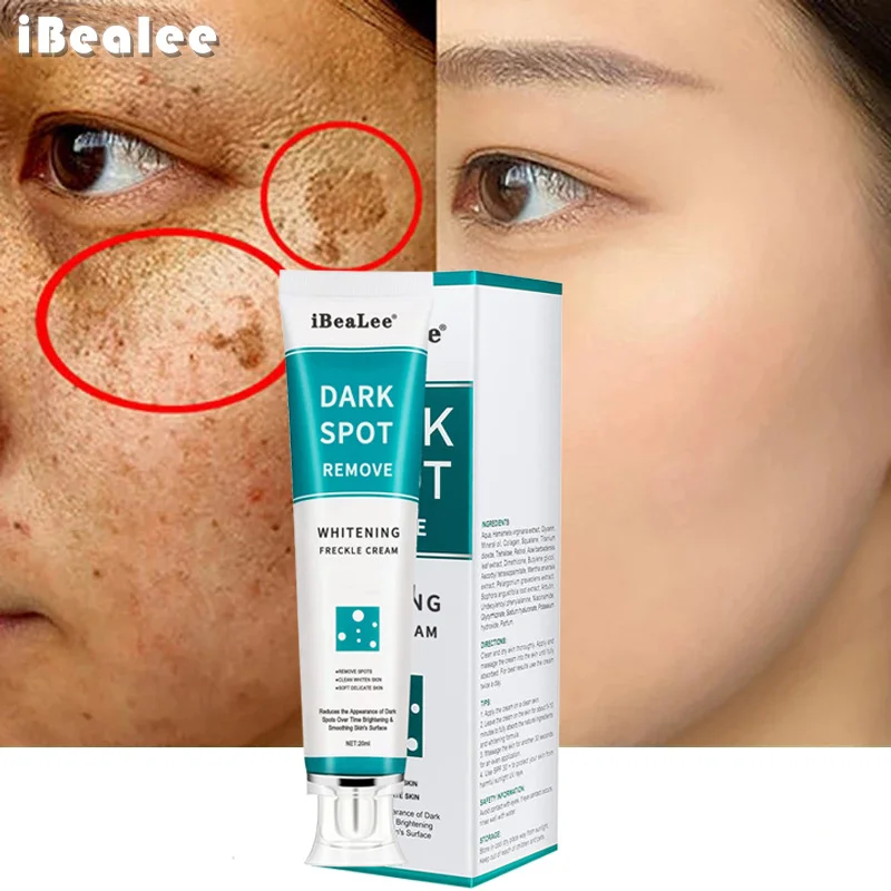 Licorice Root Sticks - Effectieve Whitening Sproeten Crème Verwijderen Melasma