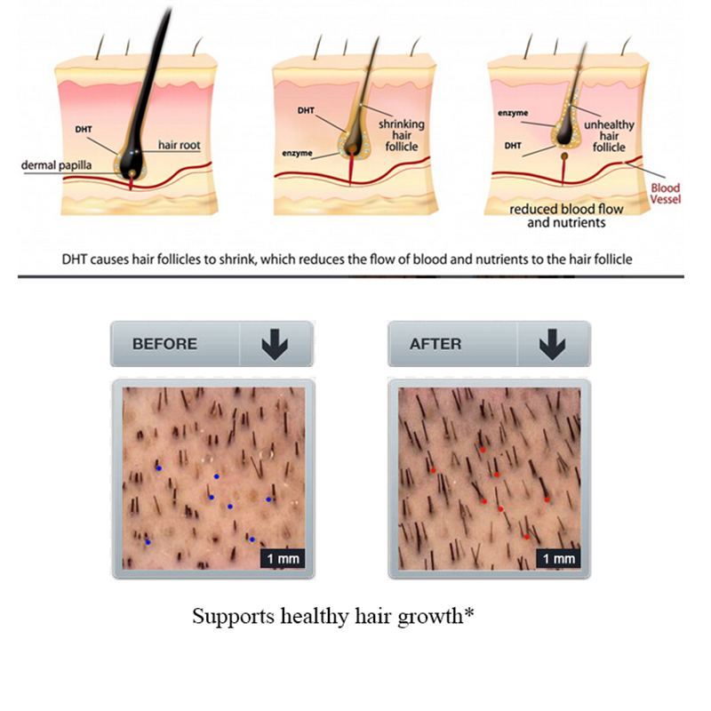 Purc 100Ml Gember Haaruitval S - Licorice Root Sticks recensie en prijs